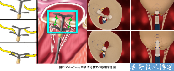 捍宇医疗：掌握核心技能 持续领跑布局平台化