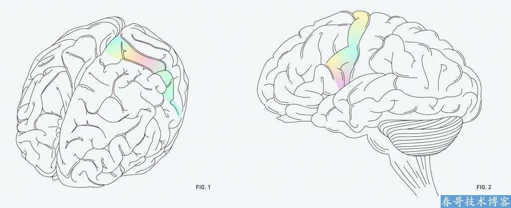 马斯克的脑机接口公司Neuralink想用用脑机接口治愈耳鸣能实现吗？